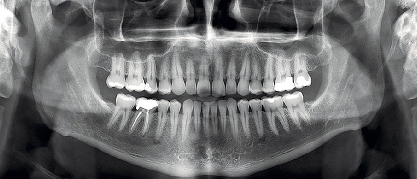 Роль рентгенівських досліджень у стоматології: нові технології для точного діагнозу в Києві